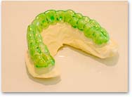 マウスピース写真