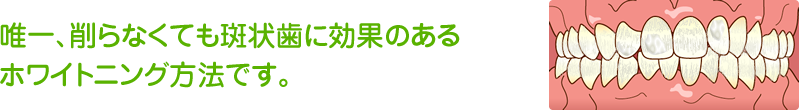 唯一、削らなくても斑状歯に効果のあるホワイトニング方法です。